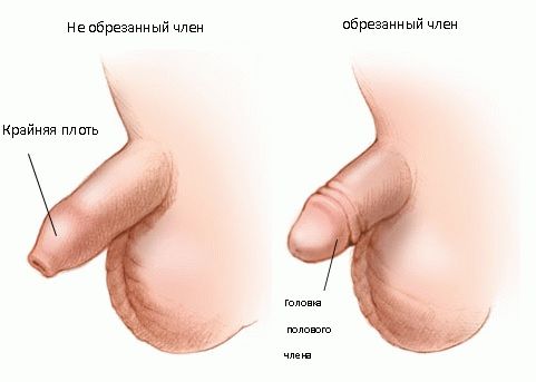фото полового члена до обрезания и после